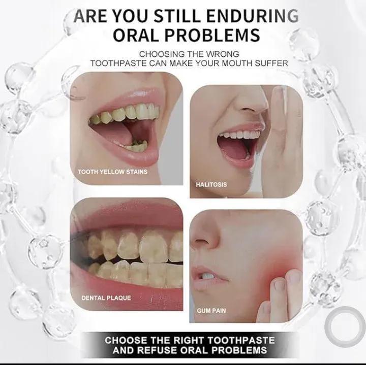 7.5% Nano Hydroxyapatite Teeth Whitening Toothpaste – 120gm